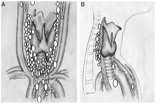 Lokalizasyon Imaging is not a diagnostic study