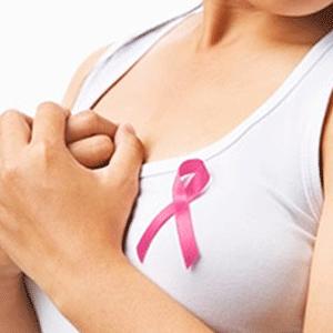X G X G BRCA 1- BRCA 2 MUTASY AALİZ KİTİ KATALG : DA.04.50 DA.04.100 Meme kanseri kadınlarda en sık görülen kanserler arasında ikinci sırada olup; akciğer kanserinden sonra en ölümcüldür.