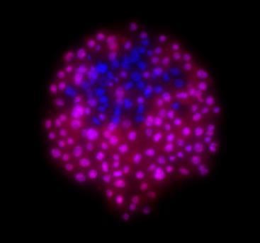 % ICM Blastokist hücre sayıları Day 5 blastocyst cell number 150 100 50 0 a b a b c d c d a a b a b b c d Total TE ICM % ICM 100 80 60 40 20 0 5% O 2 grouped 5% O 2 single 20% O 2 grouped 20% O 2