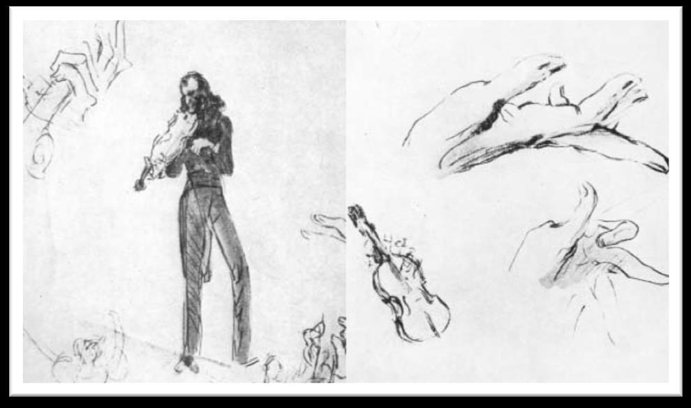 1830 daki bir konser sırasında, Ludwig Burmesister tarafından çizilen Paganini nin ellerinin pozisyonu. Paganini nin sağ elinin alçı kalıbı.