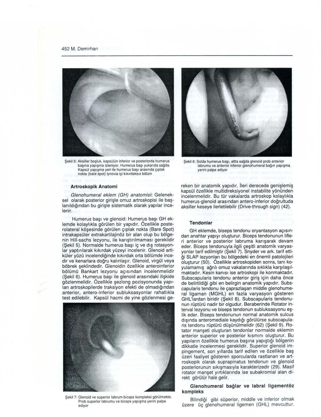 452 M. Demirhan Şeki l 5: Aksiller b oşlu k, kapsülü n inferior ve poste riarda humerus b aş ı na yapışma iz leniyor. Humerus başı y u kar ı da sağda.