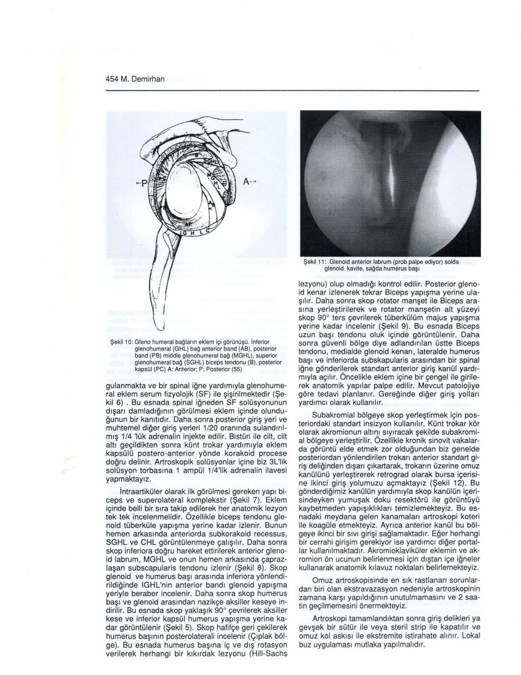 454 M. Demirhan Şekil 11: Glenoid anterior Iabrum (prob palpe ediyor) solda glenoid kavite, sağ da humerus başı Şekil 10: Glena humeral bağların eklem içi görünüşü.