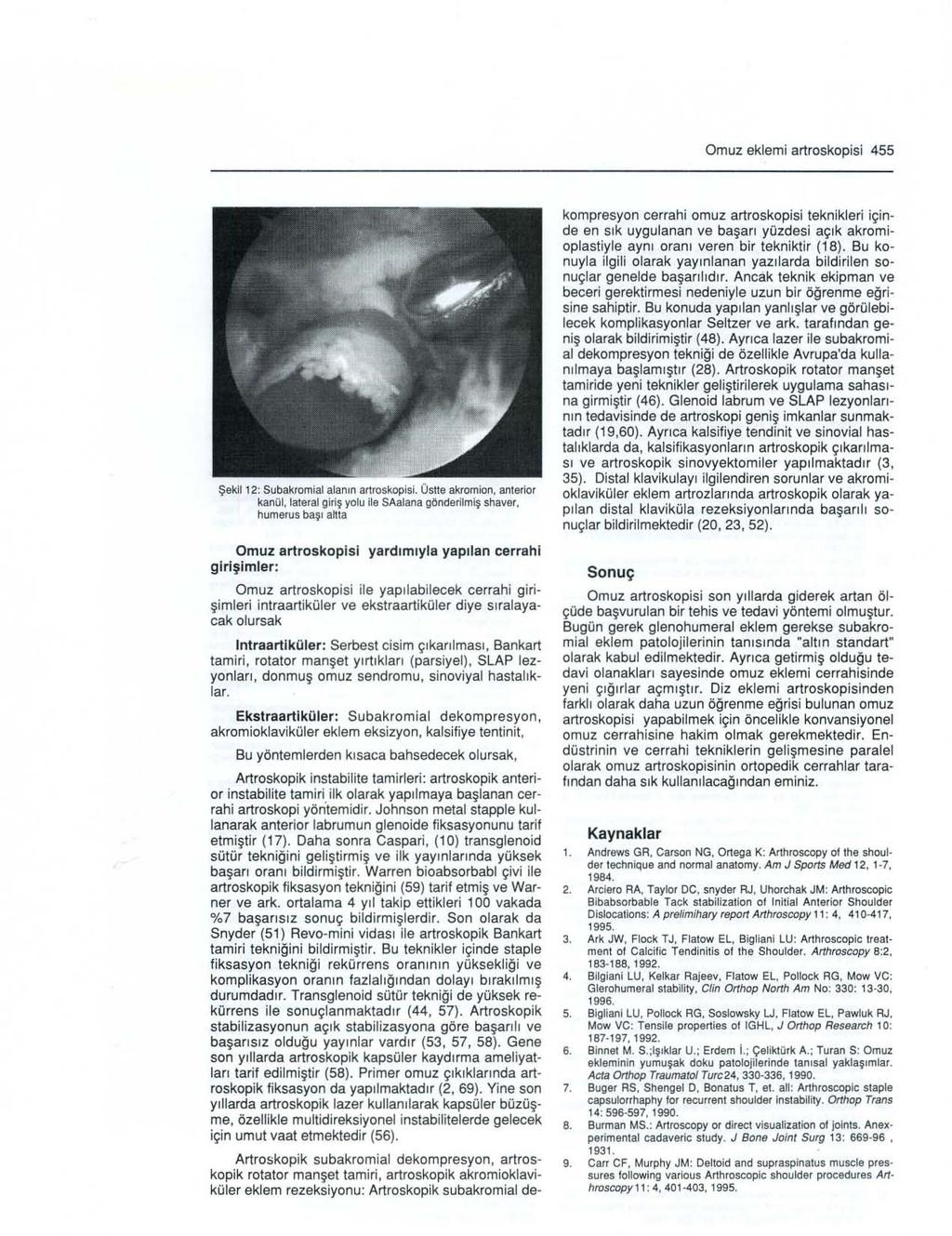 Omuz eklemi artroskopisi 455 Şekil 12: Subakromial alanın artroskopisi.
