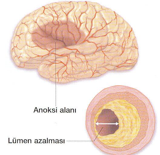 Furosemid İndikasyon: Tüm acillerde yardımcı ilaç, Volüm fazlalığında kullanılmalı Doz:40-60 mg/iv bolus Etki başlangıcı: 5 dak Etki süresi: 2 saat Yan etki: Taşikardi, volüm kontraksiyonu Urapidil α