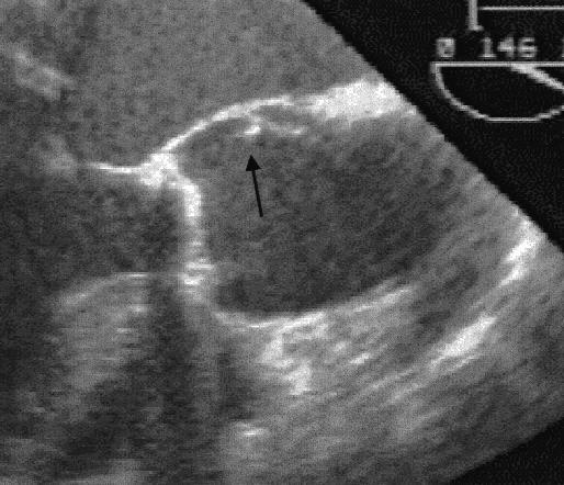 deviyasyon CT Sensitivite