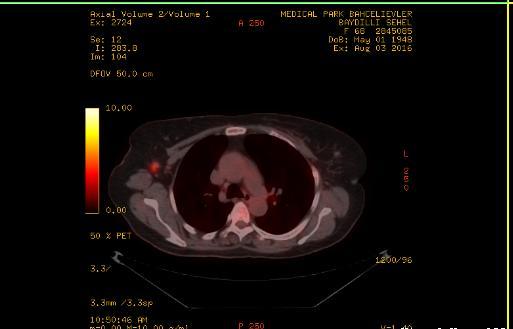 PET-CT; 9.