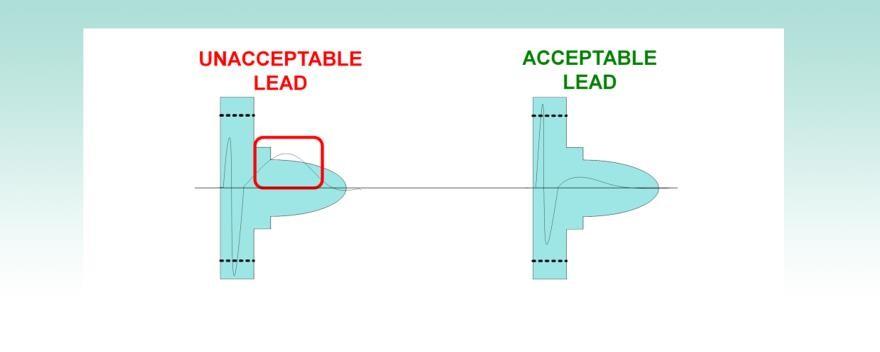 Lead Uygunluğu Hastanın S-ICD sistemine uygunluğu için