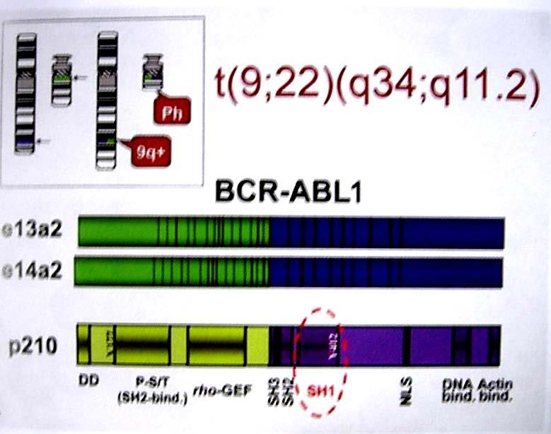 Kronik Myeloid Lösemi Genotipik Özellikler Ph pozitif KML Vakaların %90-95 inde, sitogenetik yöntemlerle t (9;22) (q34;q11) varlığı gösterilebilir