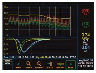 veya pressure wire).