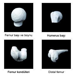 GİRİŞ Gref sözcüğü, bir kaynaktan alınan dokunun alıcı canlının dokusuna implantasyonuyla doku transferini tanımlar.