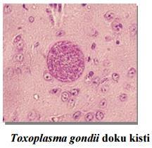 gondii seronegatif olanlarda toksoplazmoz nadir ART öncesi profilaksi almayan