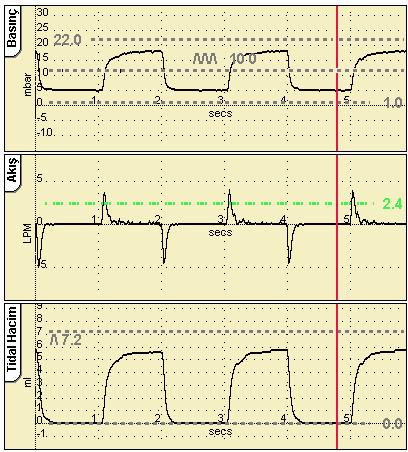 Ventilatör bir akış sensörü olmadan kullanılırken varsayılan yerleşim, akışla ilgili dalga formları hariç bırakılacak şekilde değişir.