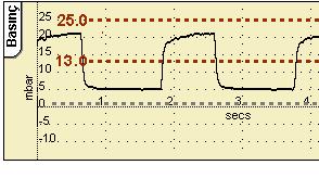 Not: Bir akış sensörü bağlandığında, Yüksek ve Düşük Dakika alarm eşikleri mevcuttur. Bu eşikler, tüm alarm eşikleriyle aynı şekilde değiştirilir.