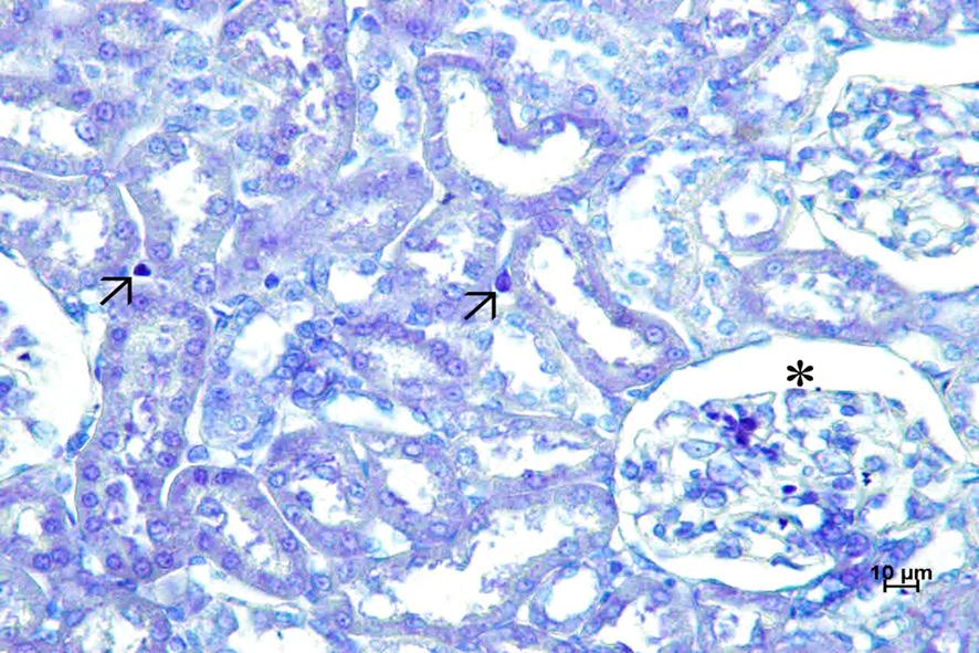 Şekil 1: Deney grubu glomerulus (asteriks) ve böbrek tubulleri arasındaki intersitisyumda ortokromatik (ince ok), metakromatik (kalın ok) mast hücreleri, toluidin blue, 40x.