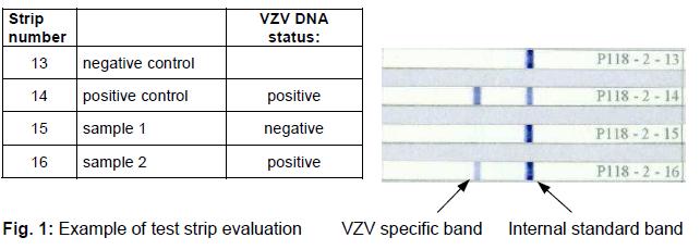 Hasta numunesi VZV DNA içerirse, patojen-spesifik bant test şeridinde görünür(fig. 1). Bütün numuneler ve kontrollerde iç standart bandı renklenmek zorundadır.
