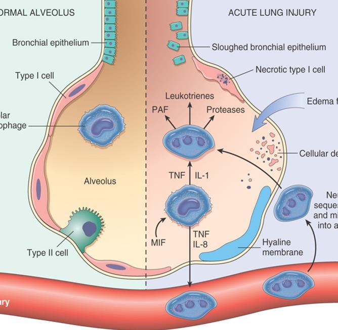 PATOFİZYOLOJİ Viral pnömoni, tbc İnhalasyon Sitopatiktir ve direk pnömositleri ve bronşial hücreleri