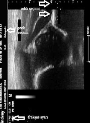Ultrasonografi uygulama tekniği Ultrasonografi cihazı 5, 7.
