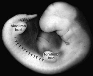 Kalça eklemi embriyolojisi Fötal evre Organların büyümesi ve fonksiyonlarının gelişimi 9. Hafta Eklem boşluğunun oluşması, kalça eklemi ve iskelet komponentlerinin vaskülaritesi 11.