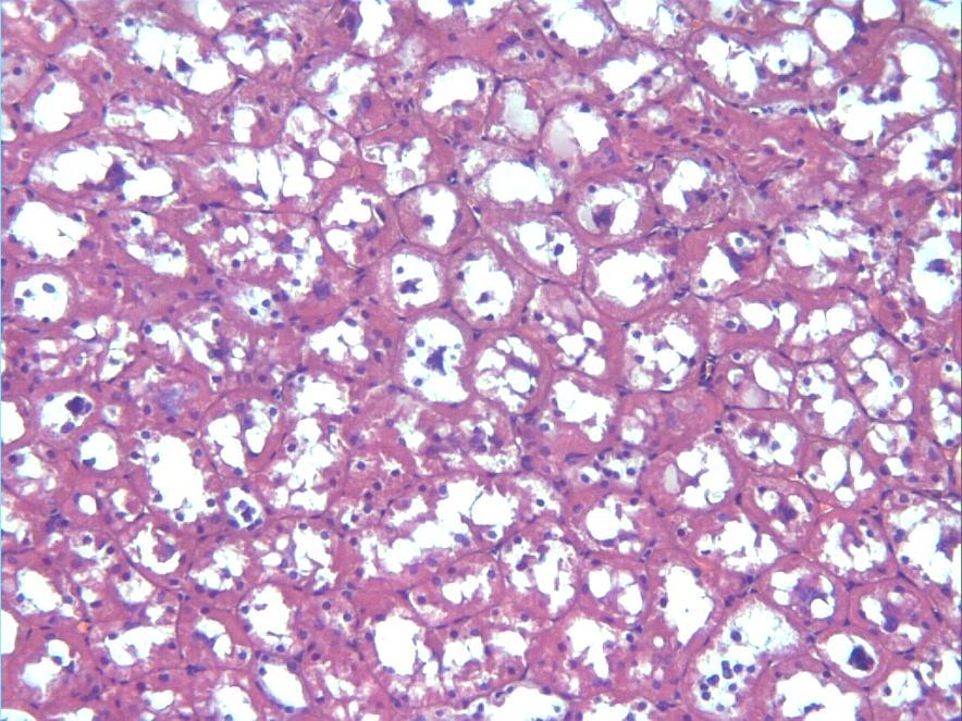 Tubullerde gözlenen değişiklikler epitelyal dökülme (Resim 9), hücre şişmesi, ve intrasitoplazmik