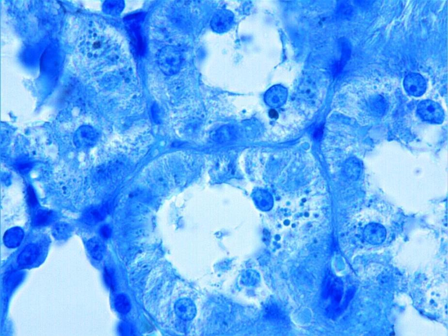 Toluidin mavisi boyama metodu uygulanan kesitlerde, proksimal tubul epitel hücrelerinin sitoplazmasında irili ufaklı, granüler görünümde yapılar izlendi (Resim 18). Resim 18.