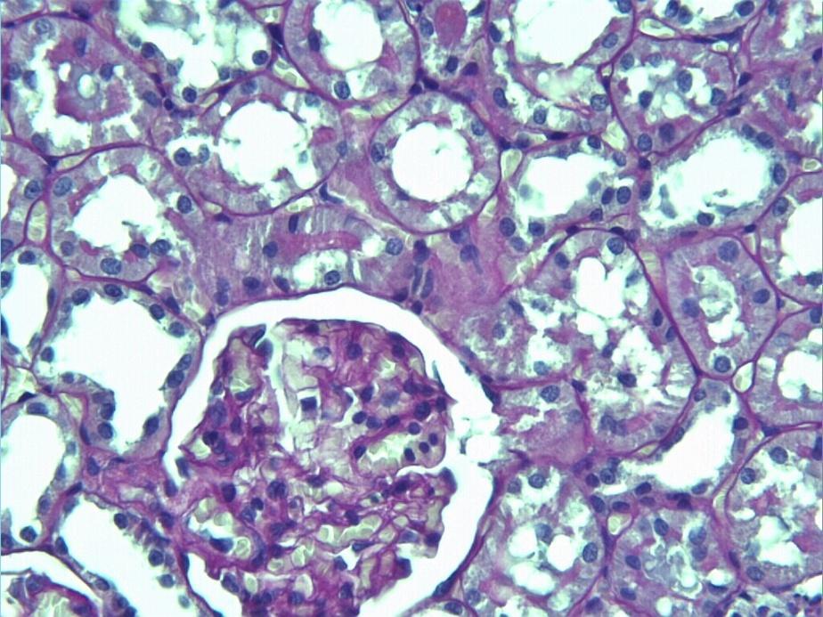 Proksimal tubul epitel hücrelerinde, apikal plazma membranlarının dökülmesine bağlı bazı tubullerde mikrovillus kaybı izlendi.