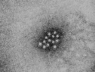 Hepatit A Virusu Küresel Zarfsız 27-28 nm