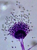 Aspergillozis Aspergillus türleri şuralarda bulunur: Toprak Hava; Sporlar inhale edilebilir Hastanelerde su / depolama tankları vs Gıda Kompost ve