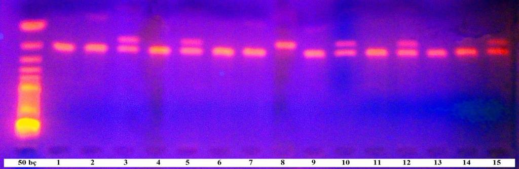 27. Calcitonin related polypeptide alpha -624 (T/C) gen polimorfizmi için hasta ve kontrol