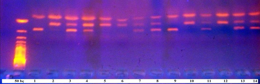 Metilentetrahidrofolat redüktaz A1298C gen polimorfizmi için hasta ve kontrol kesim ürünlerinin % 3,5 luk agaroz jelde yürütülmesi ve ultraviyole ışık altında görüntülenmesi CALCITONIN RELATED