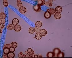 Vajinal Enfeksiyonlar Kandidiyaz: C. albicans 80-90 C. glabrata %10 C.
