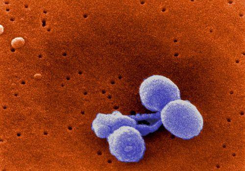 Streptococcus pneumoniae:penisilin Direnç saptanmasının önemi Antimikrobiyal duyarlılık