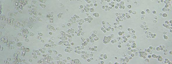 500 µg/ml, 1000 µg/ml 2500 µg/ml) J774 hücre kültürlerinde 48 saat inkübe edildikten sonra PAA nın toksik etkisi MTT yöntemi ile morfolojik ve sayısal olarak incelendi. Şekil 6.