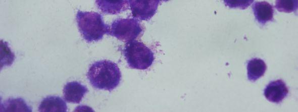 enfekte olmuş J774 makrofaj hücreleri (Giemsa boyama, 24 saat sonra,