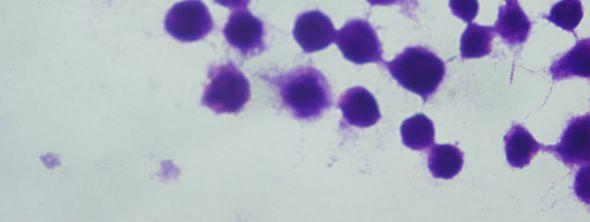 makrofaj hücreleri (Giemsa boyama, 48 saat sonra, 100x) Şekil 6.