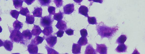 makrofaj hücreleri (Giemsa boyama, 48 saat sonra, 10