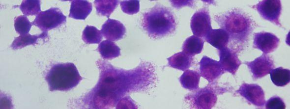 2 PAA ya (5 mg/ml, MA:100,000) Maruz Kalmış Promastigotların J774 Makrofaj Hücreleri ile
