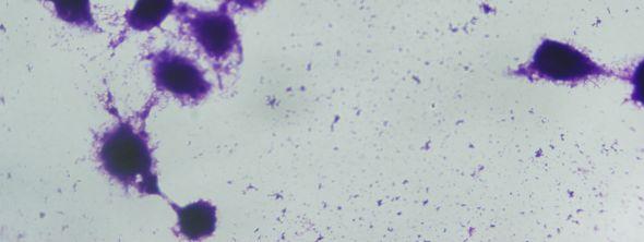 Polimere 1 saat maruz kalmış gruplarda ise enfekte makrofaj