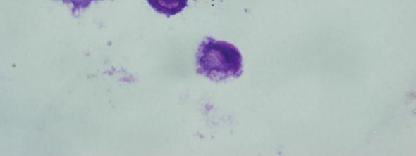 ile enfekte olmuş J774 makrofaj hücreleri (Giemsa boyama, 24 saat