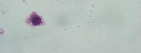 J774 makrofaj hücreleri (Giemsa boyama, 24 saat sonra, 100x) 1 mg/ml polimere maruz