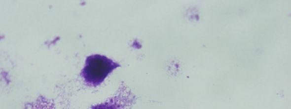 promastigotları ile enfekte olmuş J774 makrofaj