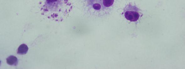 hücreleri (Giemsa boyama, 24 saat sonra, 100x) 15 mg/ml polimere 1saat maruz kalmış, 48.