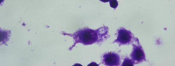 enfekte olmuş J774 makrofaj hücreleri (Giemsa boyama, 24 saat sonra, 100x) 5