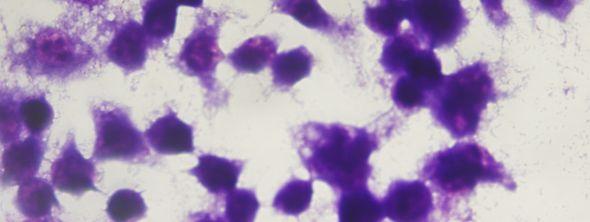 makrofaj hücreleri (Giemsa boyama, 48 saat sonra, 100x) Şekil 6.