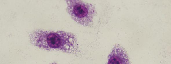makrofaj hücreleri (Giemsa boyama, 48 saat sonra, 100x) 6.4.2.
