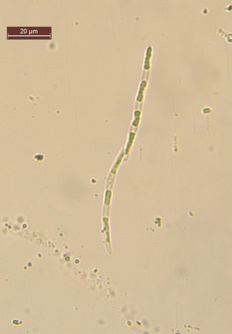 Septoria cinsine ait türler, birçok araştırmacı tarafından farklı bitki türleri üzerinde tespit edilmiştir.