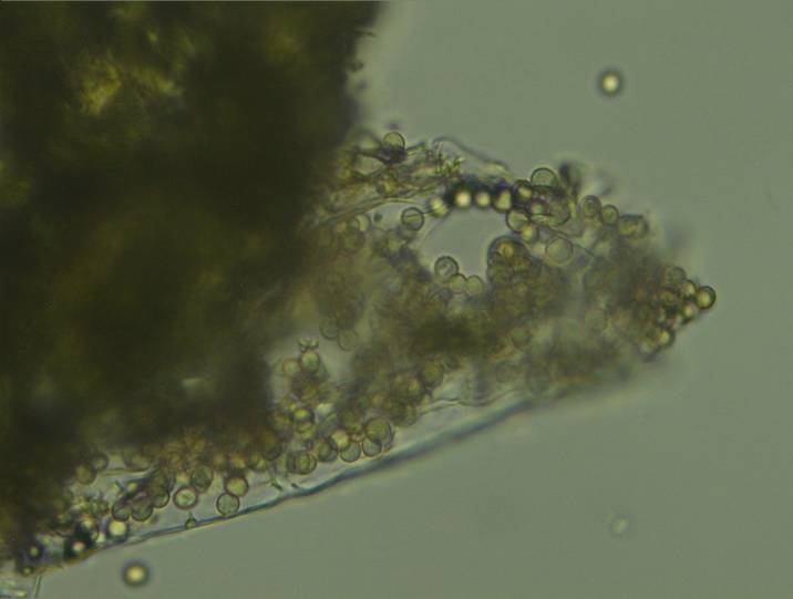 Asteraceae familyasından Conyza canadensis türünün gövdesi üzerinde semptomlar oluşturan Protomyces macrosporus, ülkemizden ilk kez teşhis edilmiş olup, Türkiye mikrofungus florası