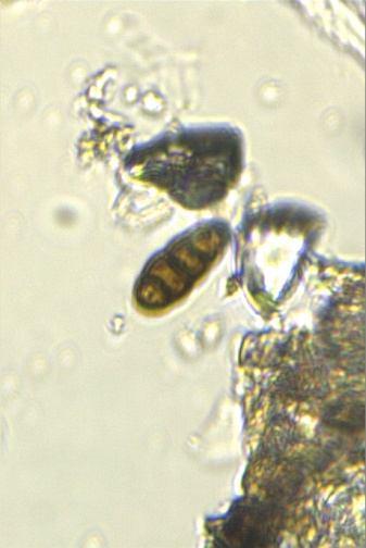 a 30 µ b Şekil 4.24 : a. Cycas revoluta üzerinde Discostroma sp. nın oluşturduğu nekrozlar; b. Discostroma sp. askosporları.