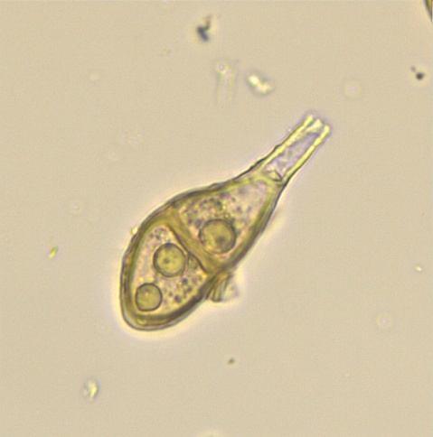 Teliosporlar tarçın renkli, saplı, her iki ucu daralmış veya bir ucu yuvarlak, az boğumlu ve 40.8-52.8 x 19.2-24 µm boyutlarındadır. Yaprak üzerinde uredosoruslara rastlanmamıştır (Şekil 4.