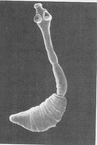 ECHİNOCOCCUS GRANULOSUS (EG) 2-7 mm boyutunda 0,6 mm eninde 3-4 halkadan oluşan parazittir. 1.