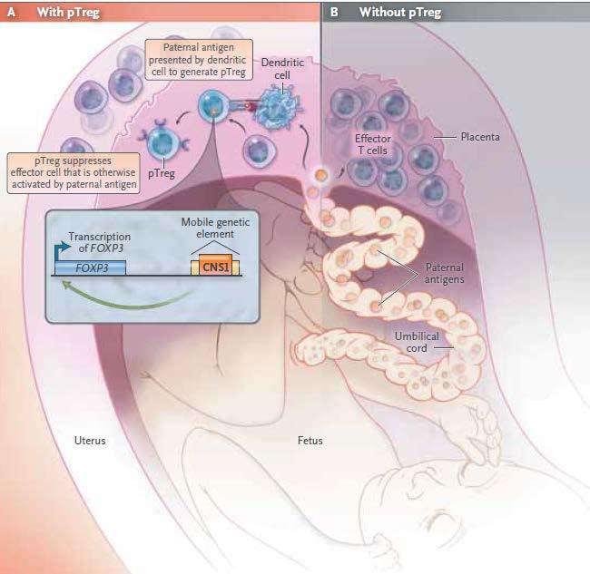 Clinical implications of basic research Inducing Tolerance to Pregnancy (4)
